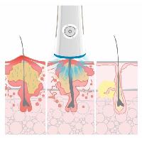 traitement-acne-traitement-imperfections traitement-acne-traitement-imperfections